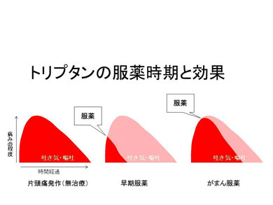 トリプタン服薬時期図