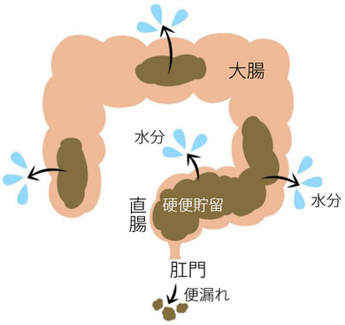 便秘,サイクル