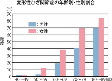 変形性膝関節症の年齢別・性別割合