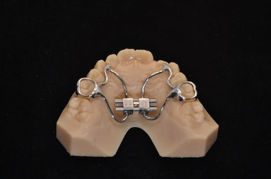 Ortodonzia digitale