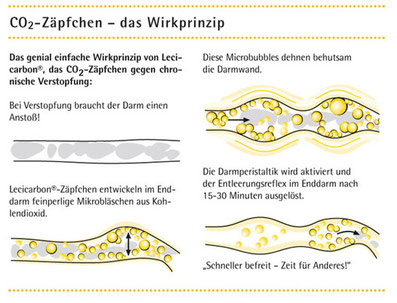 Zäpfchen gegen Verstopfung