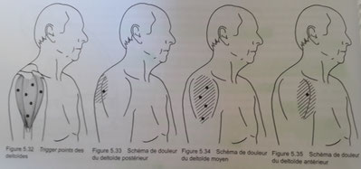 les deltoïdes