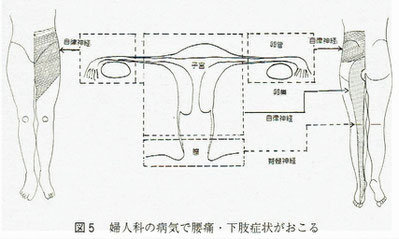 婦人科の病気で腰痛・下肢症状がおこる