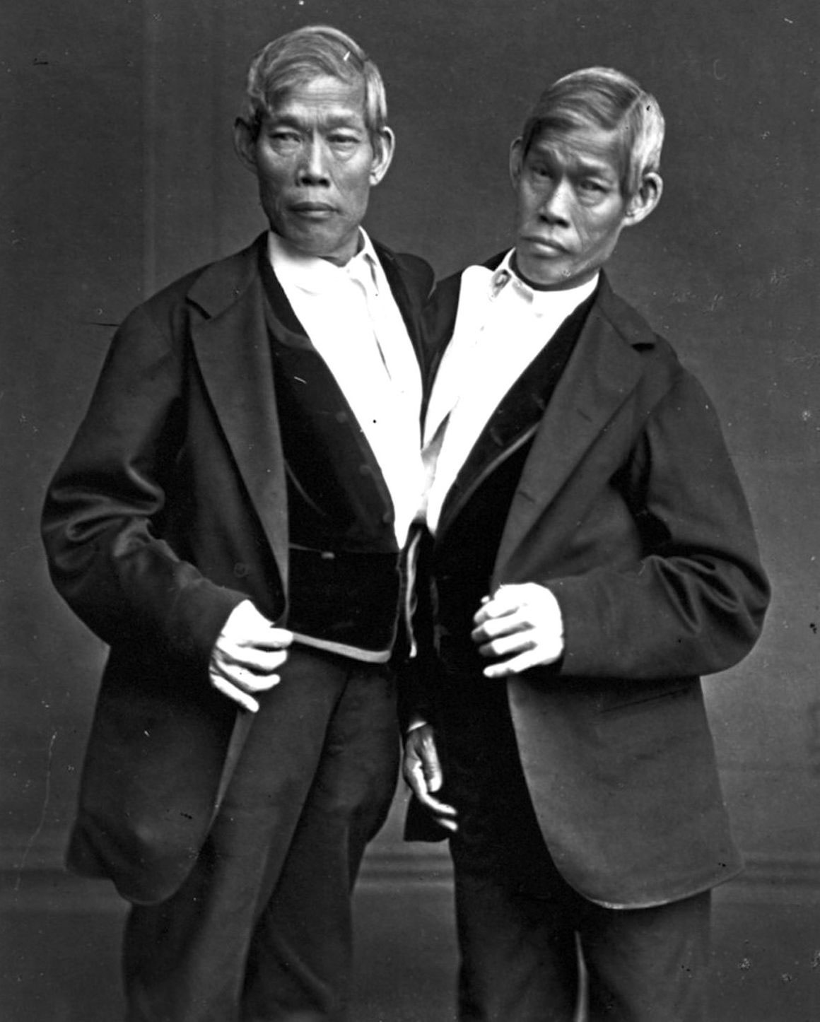 見世物 チャン エン ブンカー兄弟 シャム双生児 の語源となった見世物芸人 Subcultureat 世界のサブカルチャーのプラットフォーム 見世物 チャン エン ブンカー兄弟 シャム双生児 の語源となった見世物芸人 Subcultureat 世界のサブカルチャーのプラットフォーム