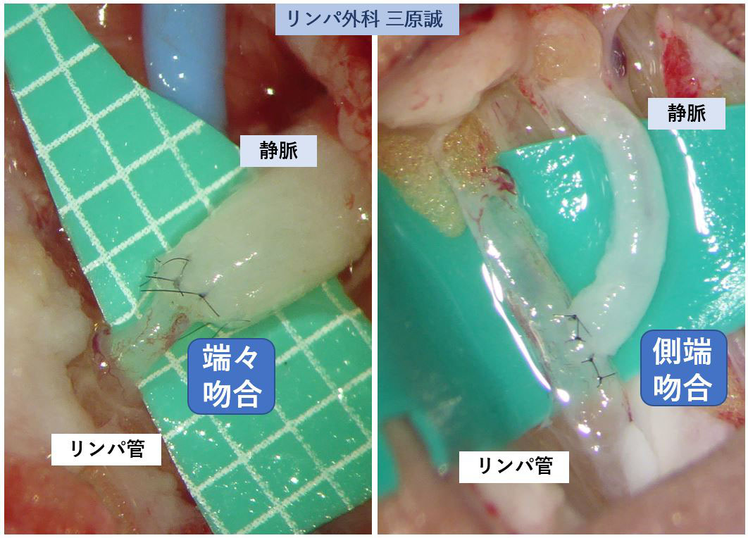 【在庫一掃】 吻合術と縫合術 ワンランクレベルアップのために : 健康・医学