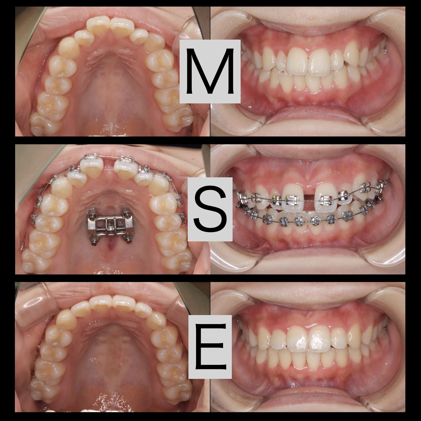 ブログ - 新大阪の歯医者｜やみか歯科・矯正歯科