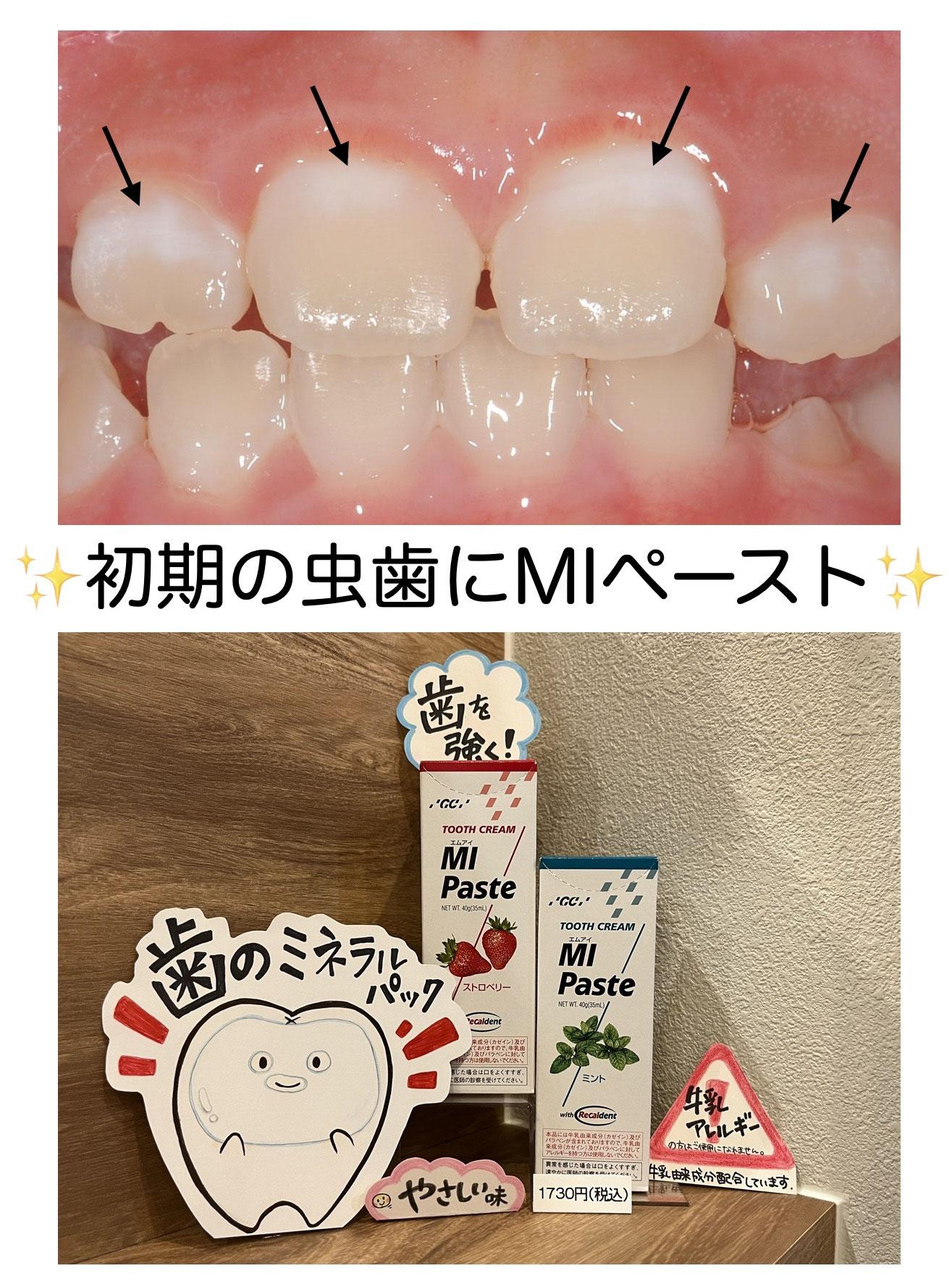 【即日発送】 初期の虫歯にお勧めの歯磨きペースト 新大阪の歯医者｜やみか - ジャケット・アウター
