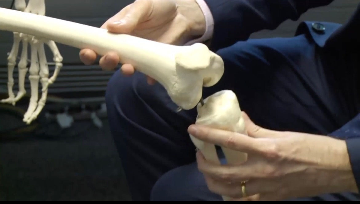 Musculoskeletal embolization CVIR Endovascular CIRSE's open access