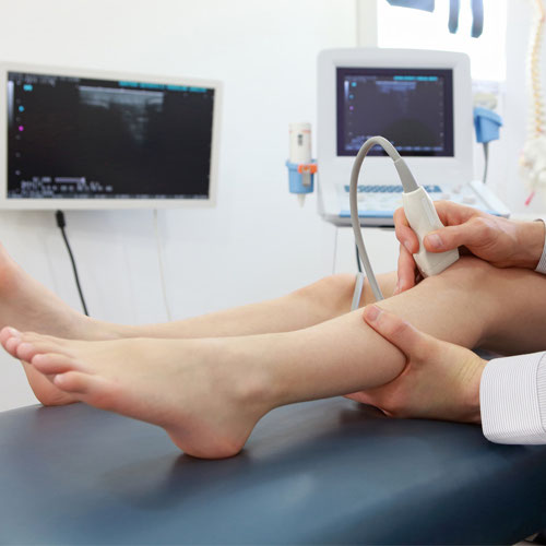 Ecodoppler Venoso Arti Inferiori Costo CHE COS'E' L'ECOCOLORDOPPLER? - Benvenuti su studimedicispecialistici!