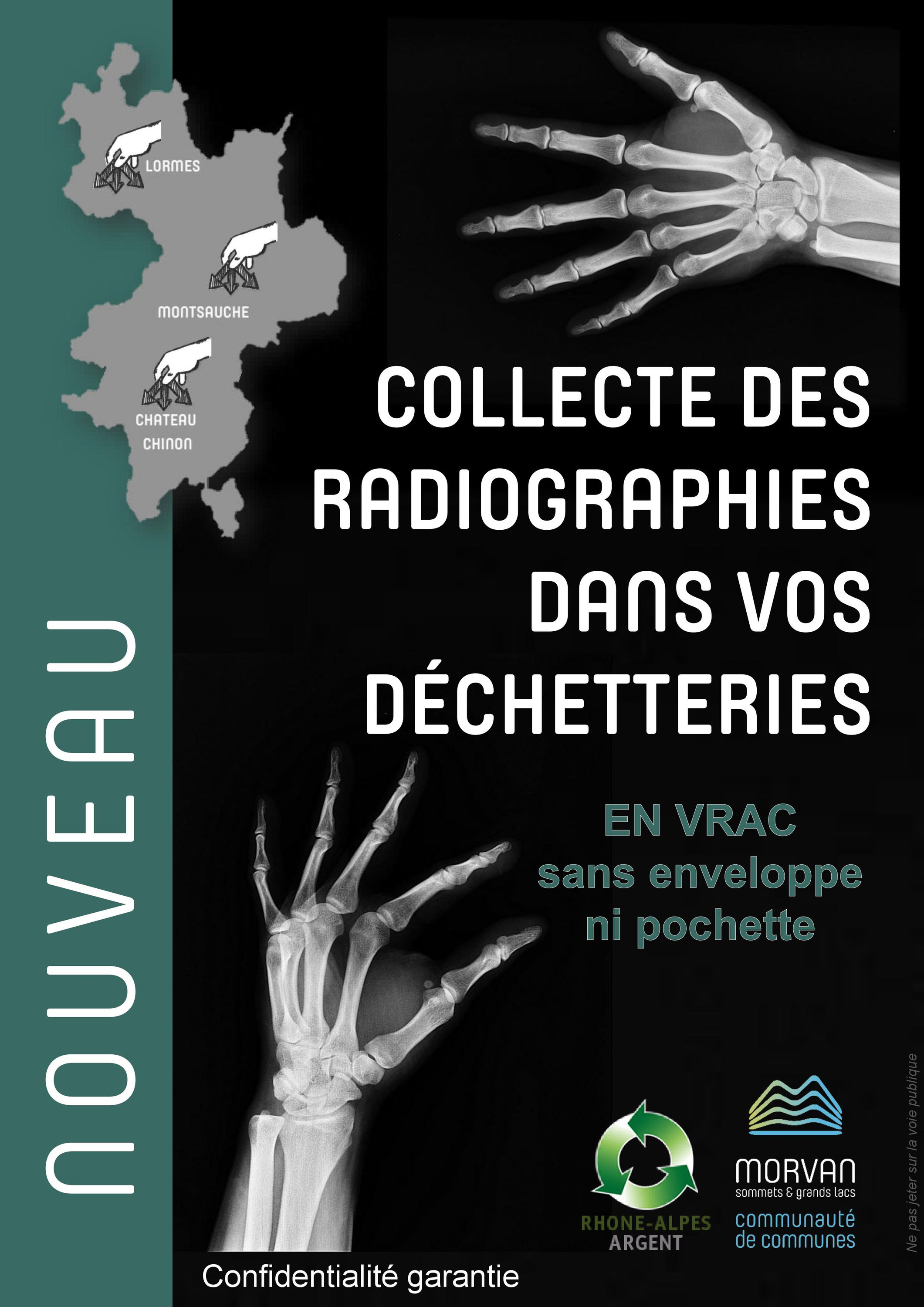 Nouvelle Collecte En Dechetterie Les Radiographies Medicales Argentiques Site De Ccmorvan