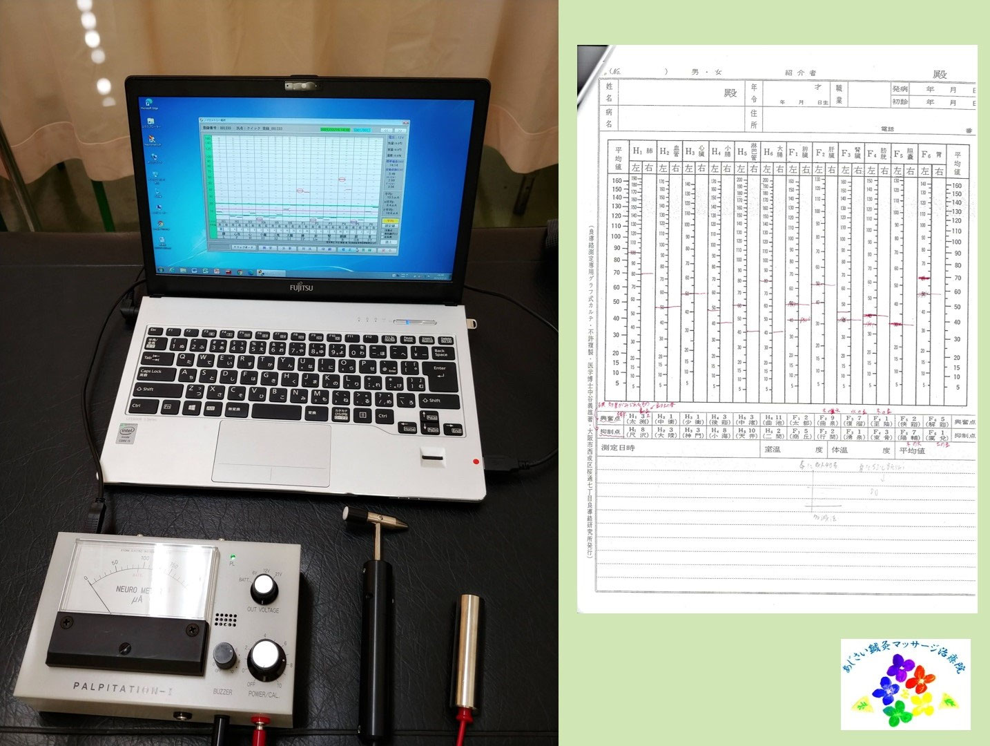 鍼施術の良導絡用のツボ音響探査装置内蔵のノイロメーターです。 鍼施術の良導絡用のツボ音響探査装置内蔵のノイロメーター