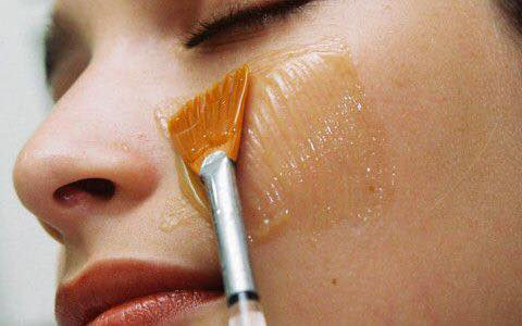 peeling chimico viso costo