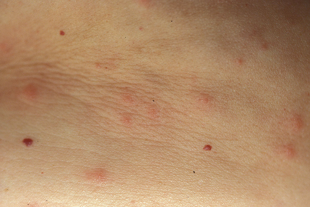 Dermatose Du Chien Et Contagion Consultations En Dermatologie Veterinaire