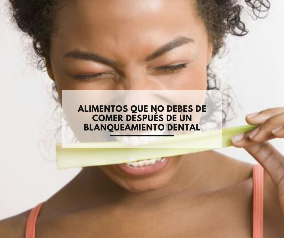 Lista 33+ Imagen de fondo se puede comer lechuga después de un blanqueamiento dental Lleno Lista 33+ Imagen de fondo se puede comer lechuga después de un blanqueamiento dental Lleno
