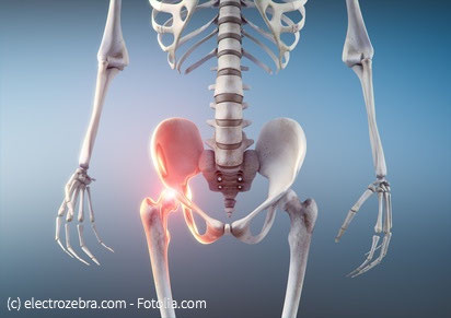 Die 3 Wichtigsten Ubungen Gegen Huftschmerzen Coaching Fur Introvertierte Hsp Infj Dusseldorf