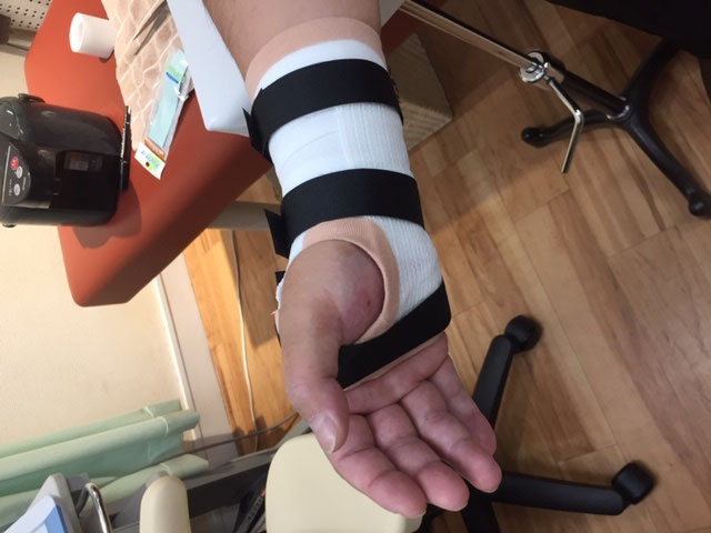 尺側手根伸筋腱炎 腱鞘炎 の症例 きしざわ整骨院 接骨院 尺側手根伸筋腱炎 腱鞘炎 の症例 きしざわ整骨院 接骨院