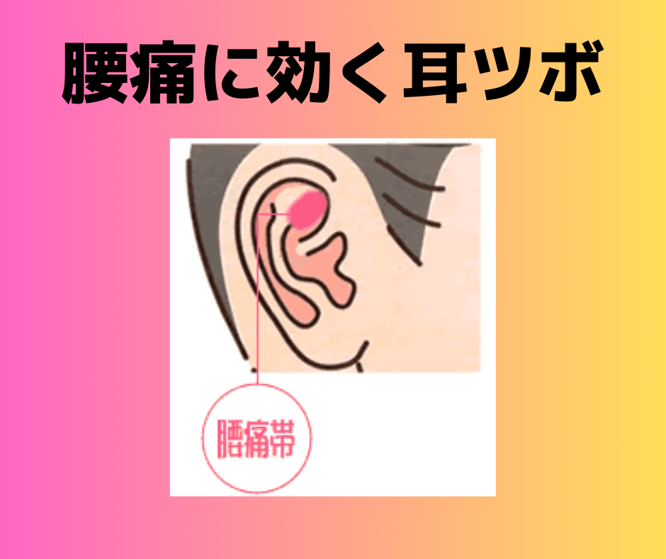 自分で出来る耳ツボキット♡ 腰痛改善！！ いいはる