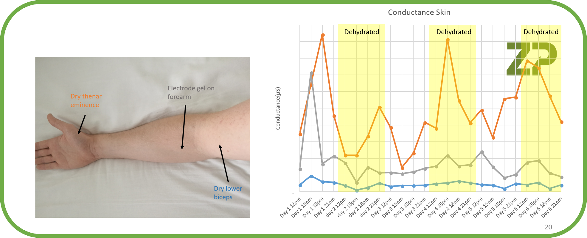 Wearable Skin Sensors and understanding the Signal zimmerandpeacock