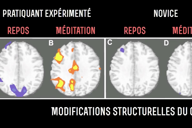 La Méditation C Est Bon Pour Le Cerveau Méditation : Les 7 Bienfaits scientifiquement prouvés sur Votre Cerveau