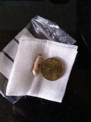 Der Rest des Zahns mit Wurzel