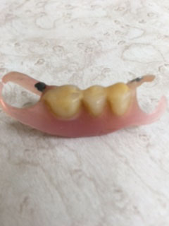 たかす歯科クリニック義歯