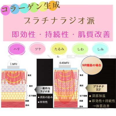 世界初プラチナラジオ派