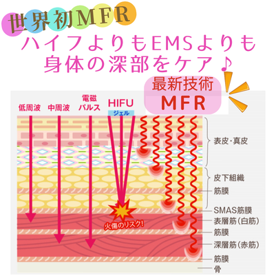 ハイフ以上の効果NR