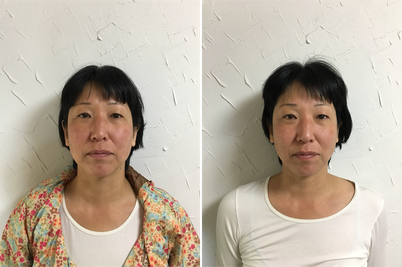 左ビフォー 右アフター