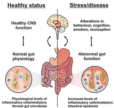 What Causes Constipation? Why am I Always Constipated ...