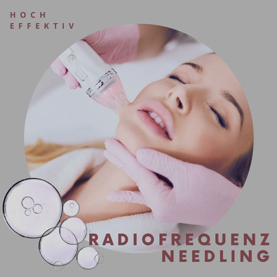 RF Needling