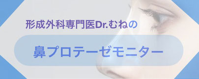 形成外科専門医・保坂宗孝は、鼻プロテーゼモニターさんを大募集しております。