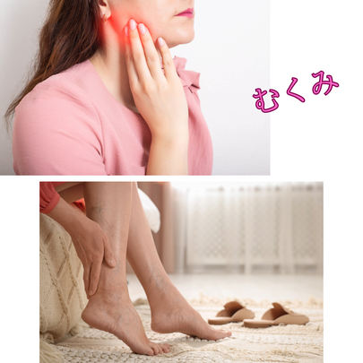 むくみケア