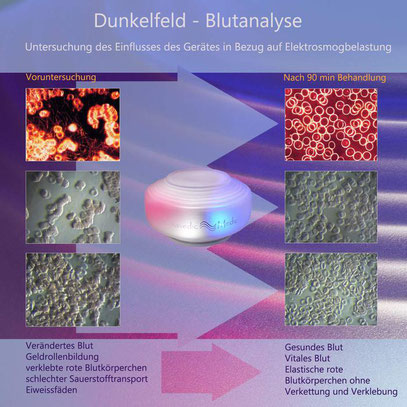 Somavedic - Dunkelfeld - Blutanalyse - Voruntersuchung & nach 90 Minuten Behandlung