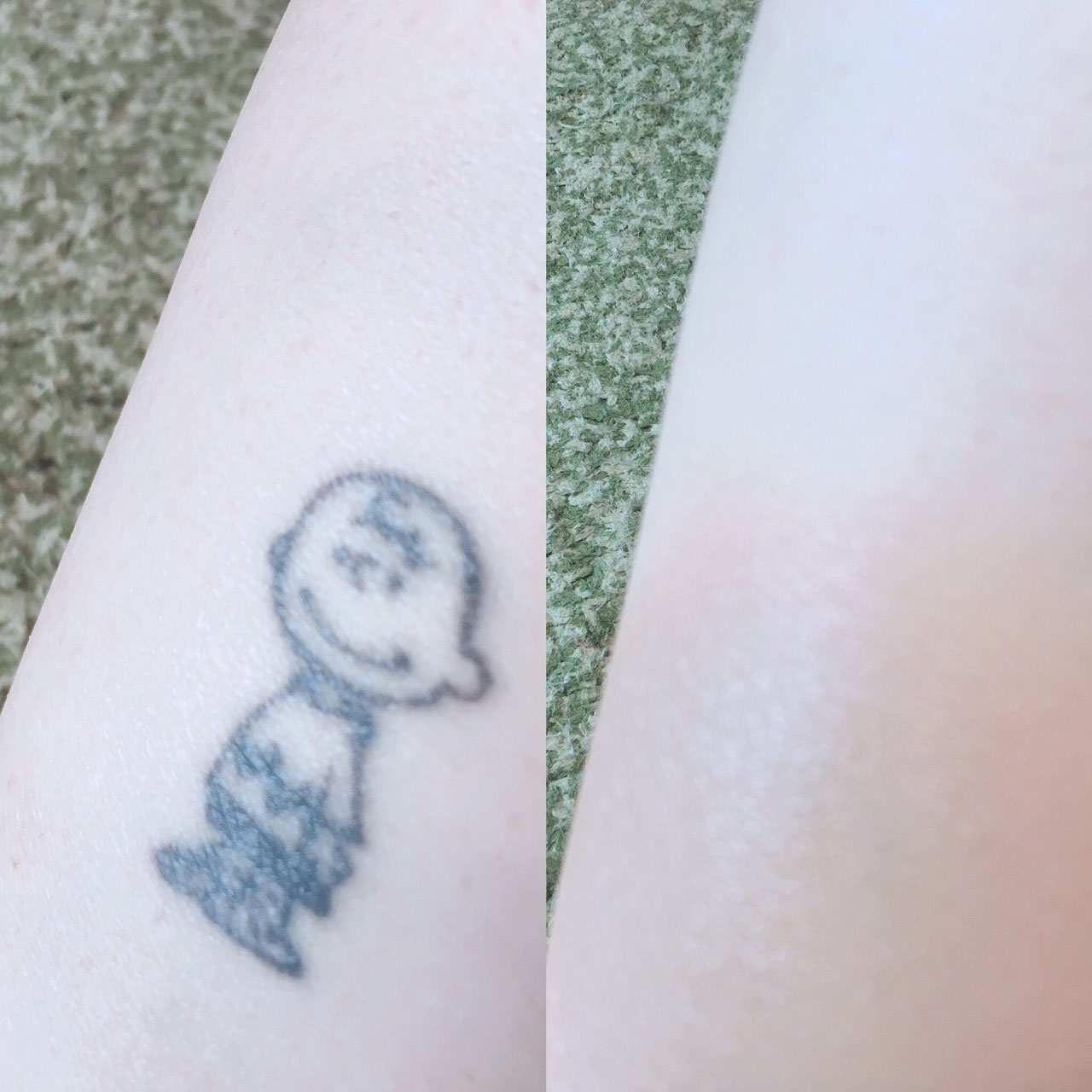 カクシス ご利用 ビフォーアフター Dip 総販売代理店 Maborun カクシスボディーファンデーション タトゥークラブ