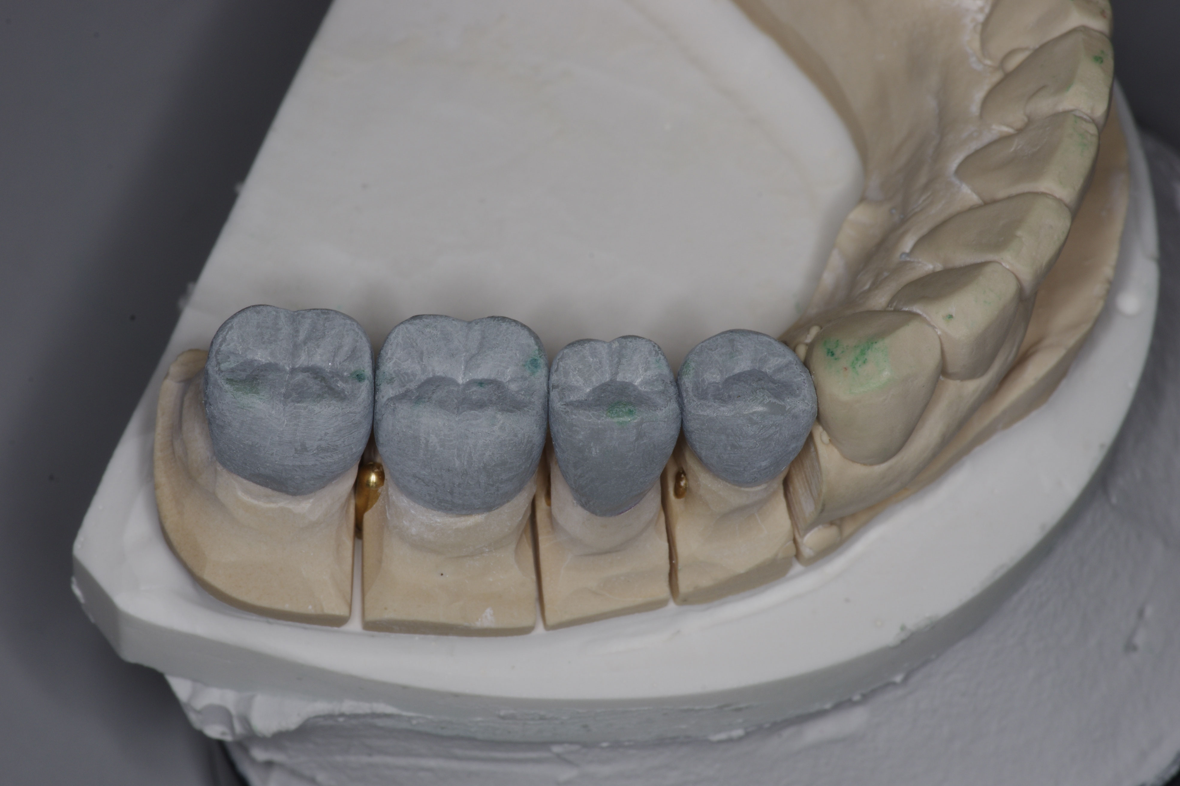 ＜保険のCAD/CAM冠も扱っております＞ - 東京下町の歯科技工所／技工所／職人歯科技工士／ジルコニア/e.max／bio-tec-tokyo