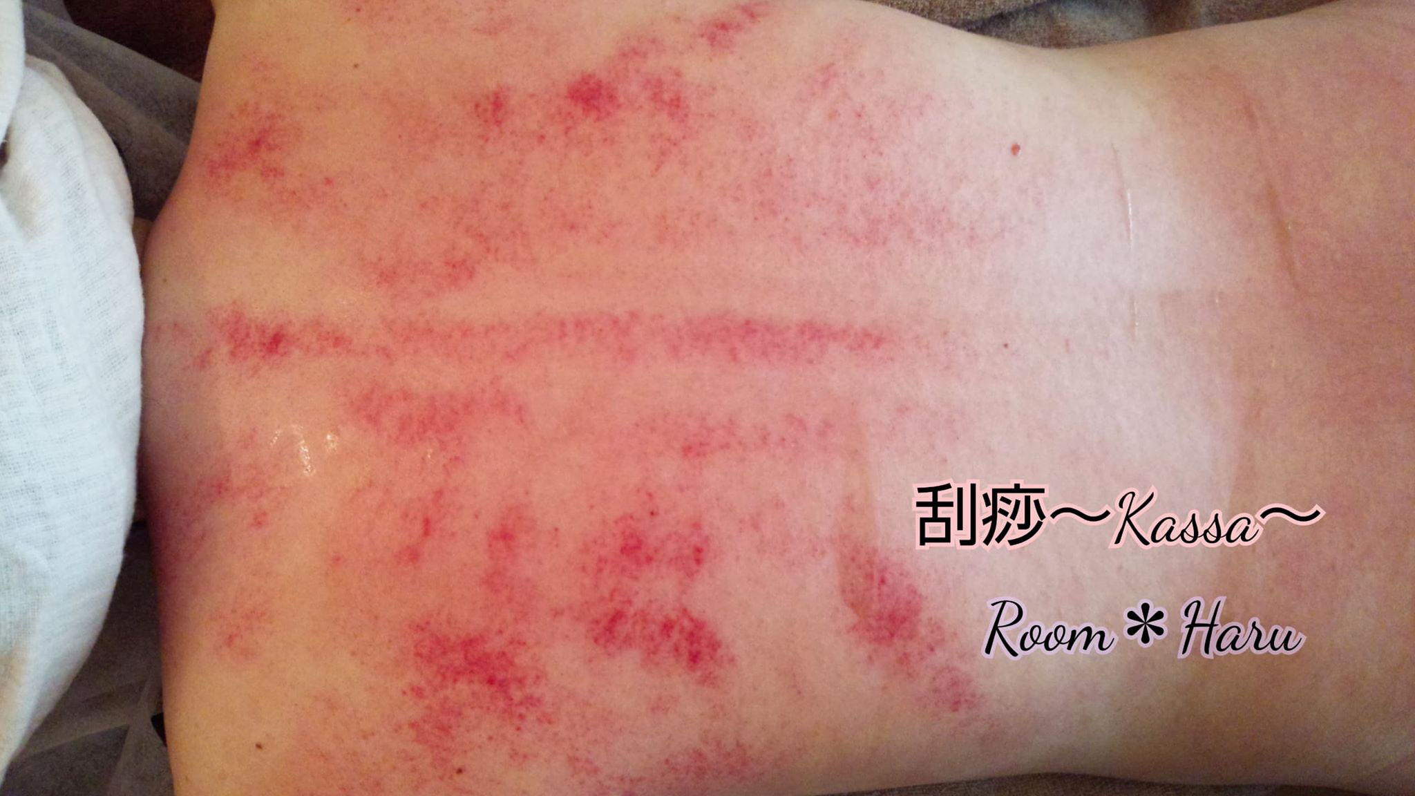 福岡 Roomharuかっさ アロマ カッピング 数秘サロン スクール かっさ アロマ カッピング 数秘サロン スクール 福岡 Roomharuかっさ アロマ カッピング 数秘サロン スクール かっさ アロマ カッピング 数秘サロン スクール