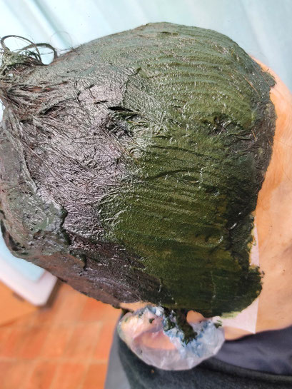 紫紺色で生え際