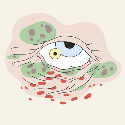 Another old eye