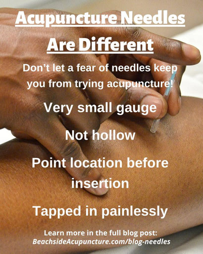 Acupuncture Needles on the Beachside Blog