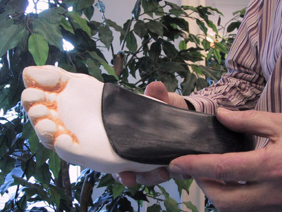 demonstrating a finished custom orthotic fitted to a cast