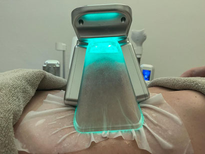 Kryolipolyse Praxis in Basel