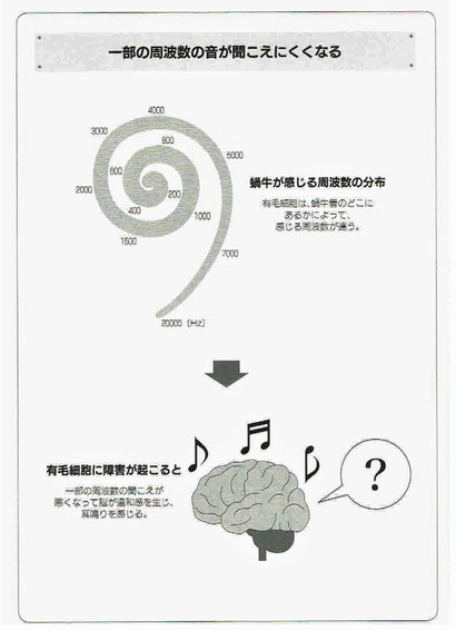 一部の周波数の音が聞こえにくくなる