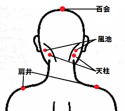 閃輝暗点の治し方　ツボ