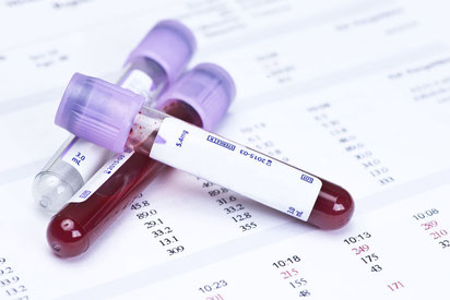  Labordiagnostik- Monovetten- Blut