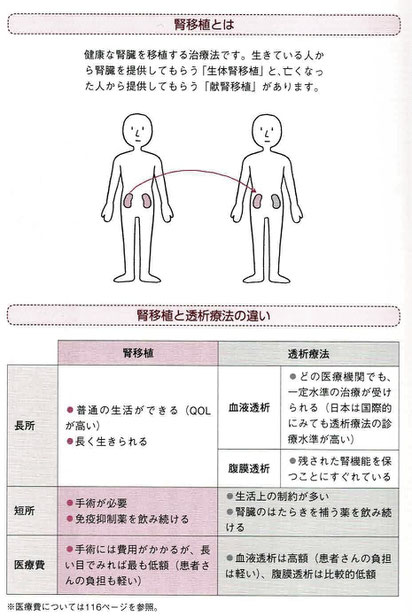 腎移植とは