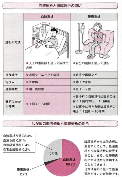 血液透析と腹膜透析の違い