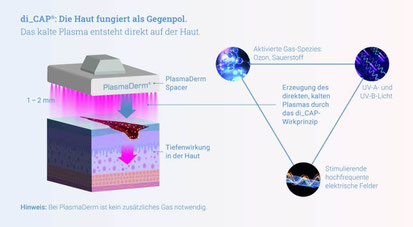 Patentierte di_CAP® Technologie zur Kaltplasma Erzeugung