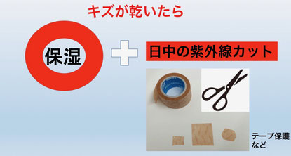 創部が乾燥したら、保湿や紫外線対策を行います。