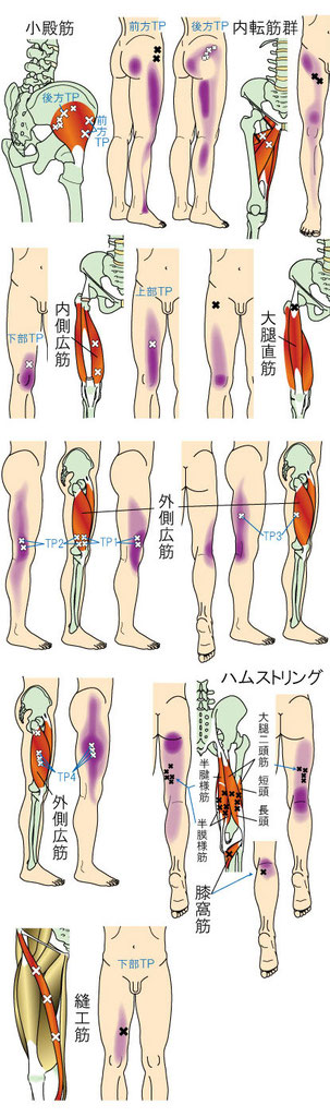 膝・下腿・足に痛みをもたらすトリガーポイント