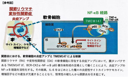 関節炎における炎症アンプ